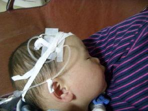 扎针吃小瓜会胖吗视频讲解,揭秘减肥新方法，真的会胖吗？